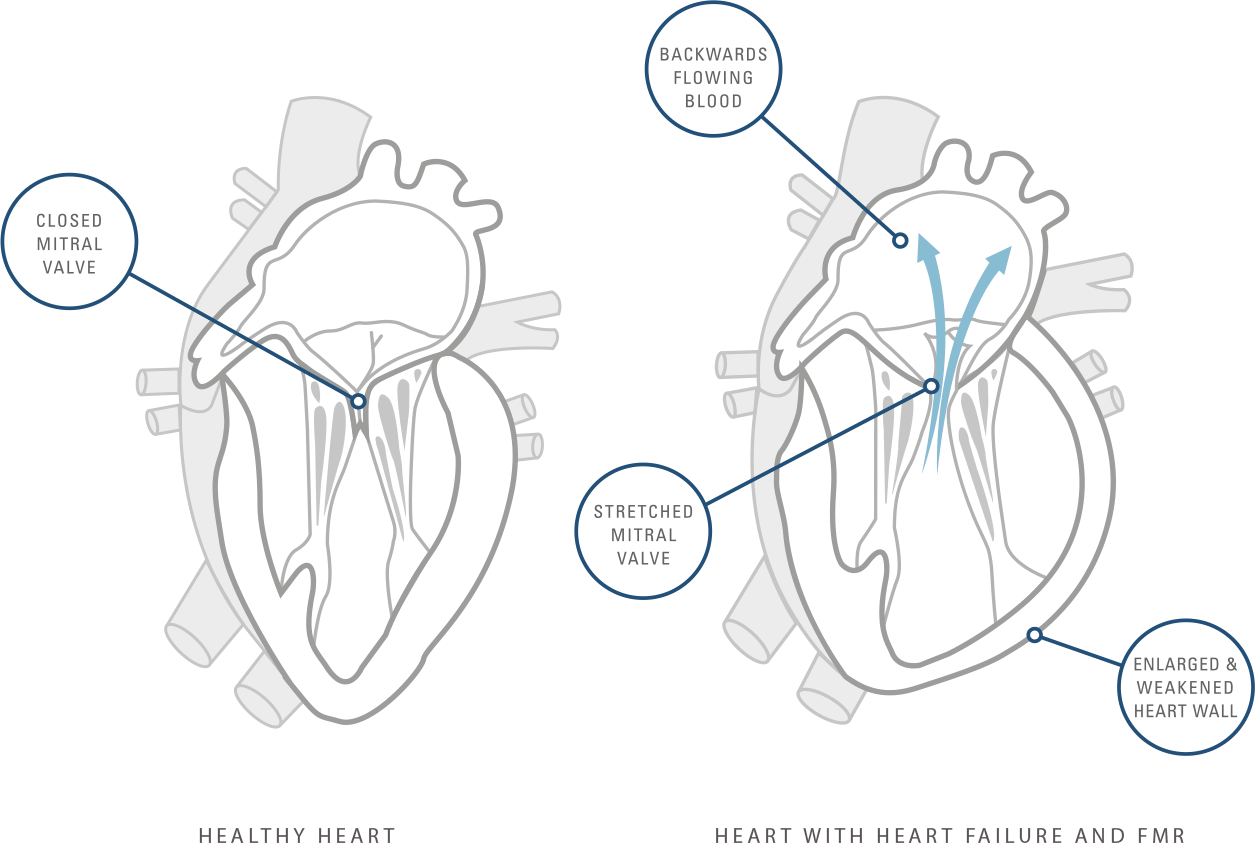 heart-graphic